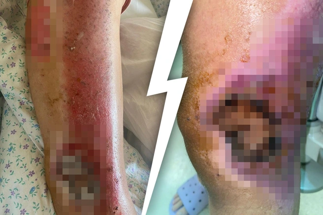 f1442e126bd2a7b62c9201c251ec52f4